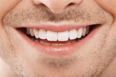 closeup look at a man's smile after periodontal treatment from Pacific Coast Dentistry