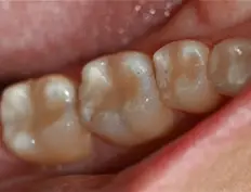 After image