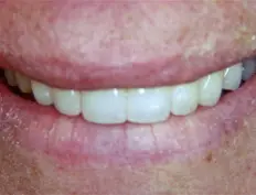 After image