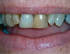 Before image