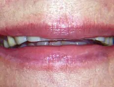 Before image