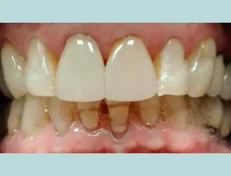Before image
