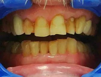 Before image