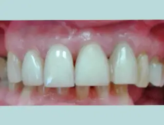 Before image