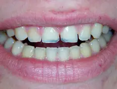 Before image