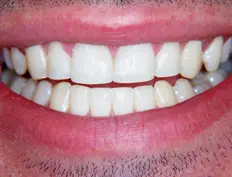 After image