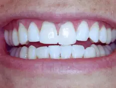 After image