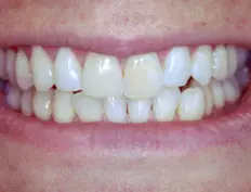 Before image