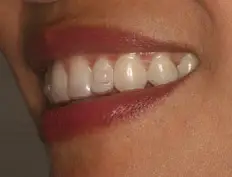 After image