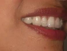 Before image