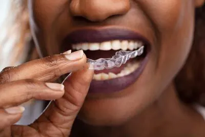 woman putting in her new Invisalign clear aligners